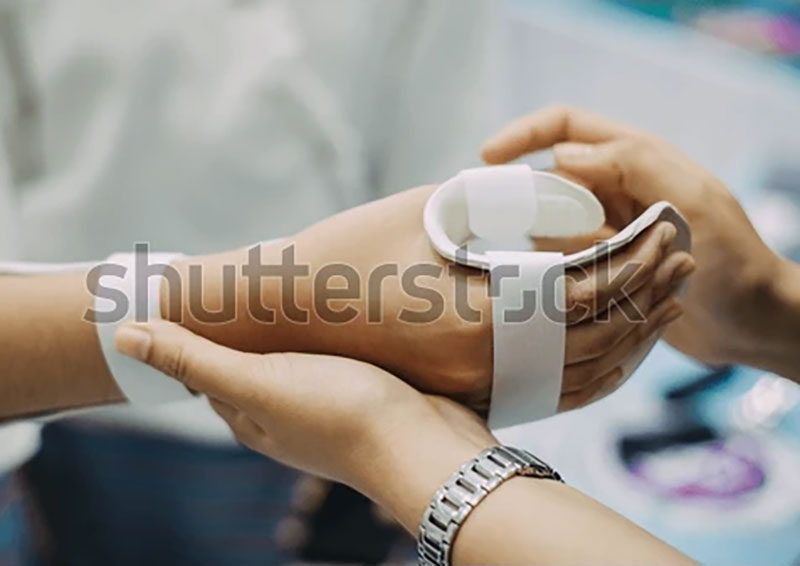 TEMP-therapist-making-asissistive-device-immobilize-shutterstock-2317374301
